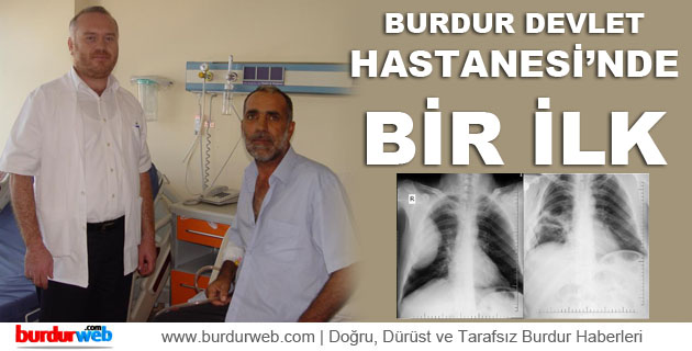 Burdur Devlet Hastanesi’nde Bir İlk