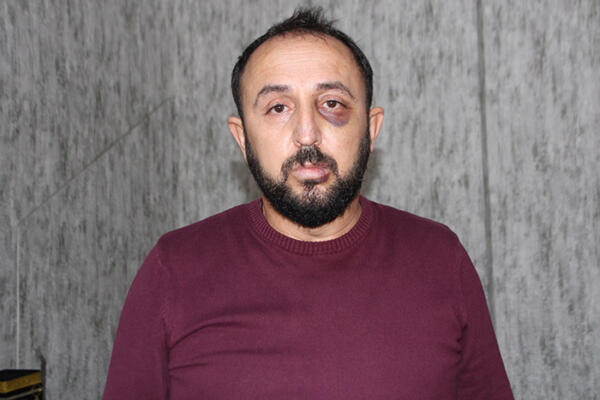 Darp iddiası