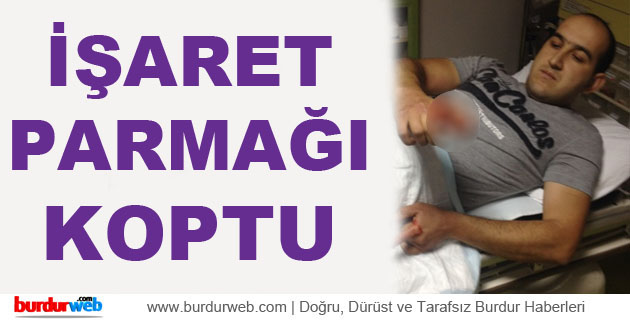 İşçinin Parmağı Koptu