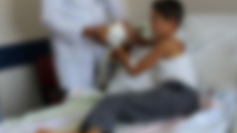 Tehlikeli oyun serçe parmağını kopardı